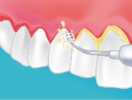 http://dentyss.com/wp-content/uploads/2019/09/Traitement.jpg
