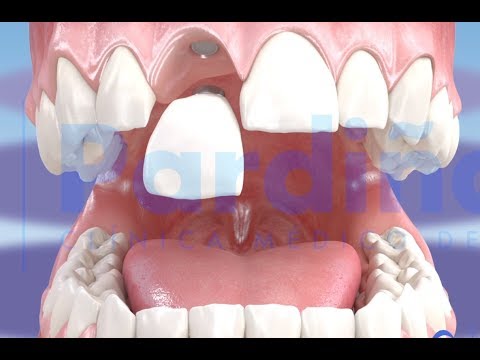 Atlanta-Dental-Trust-After-01